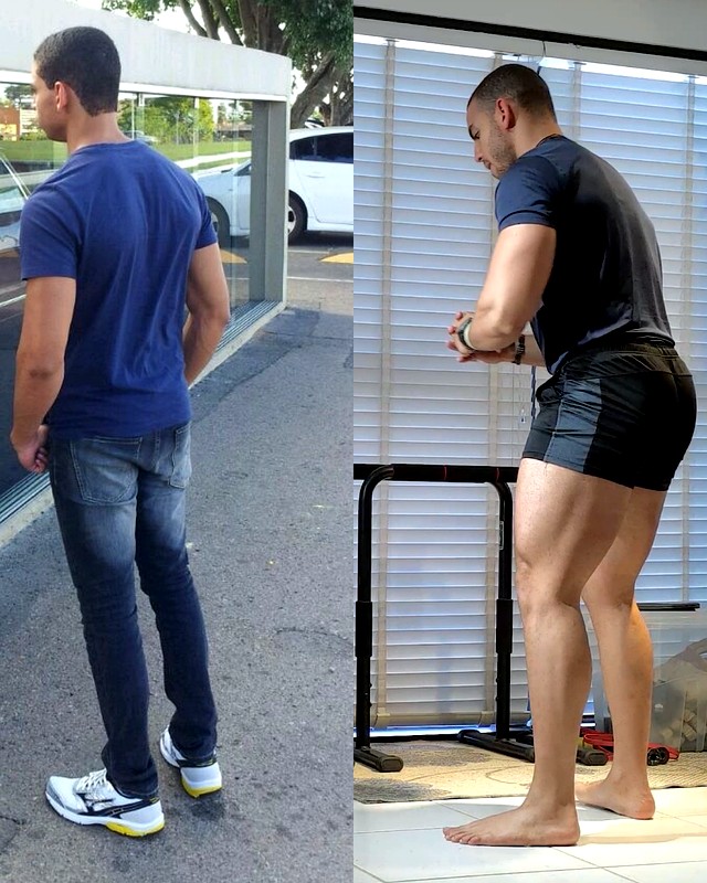 Evolução de 3 meses aplicando o método Glúteo PRO